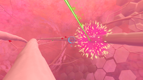 VR en pijnbestrijding: ervaringen en tips