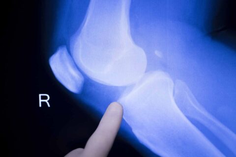 Ziekenhuizen volharden in zinloze zorg